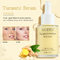 Turmeric Anti Acne Whitening Organic Face Serum 30ml / Bottle