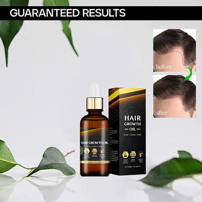 Private Labe Hair Growth Oil With Caffeine, Biotin For Stronger, Thicker, Longer