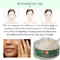Herbal Anti Acne Cream Scar Remove Treatment Cleansing Face Cream